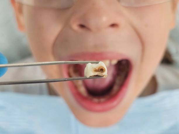 Best Knocked-Out Tooth Emergency  in La Marque, TX